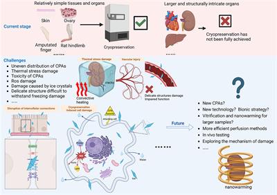 Cryopreservation of tissues and organs: present, bottlenecks, and future